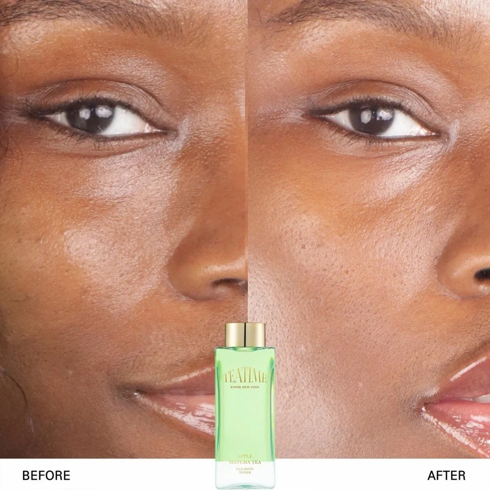 ✨ Byroe New York – Tea Time Apple Matcha Tea Clearing Toner 🎀